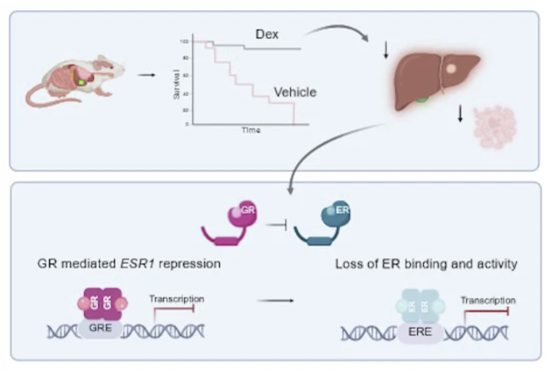 Activated glucocorticoid receptor is an estrogen receptor silencer in ER+ metastatic breast cancer